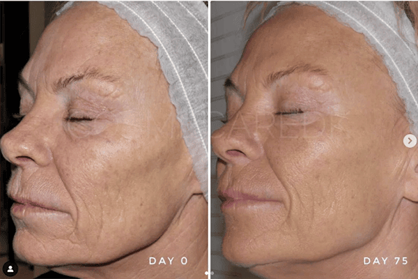 Lumixa Phototherapy and LED System