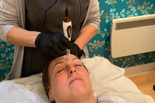 Microneedling and Mesotherapy